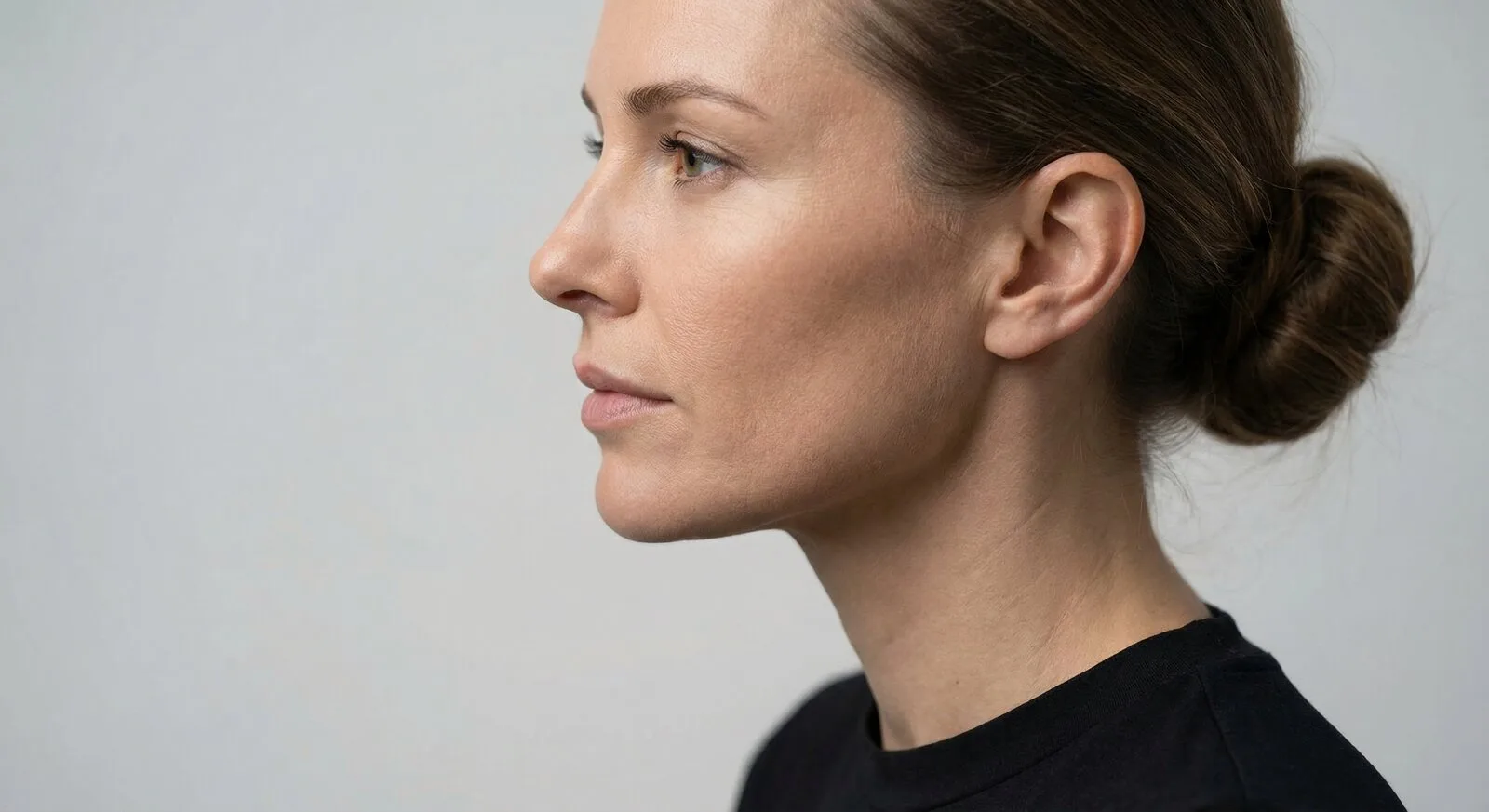 Perfil facial feminino usado para explicar mentoplastia e harmonia do queixo