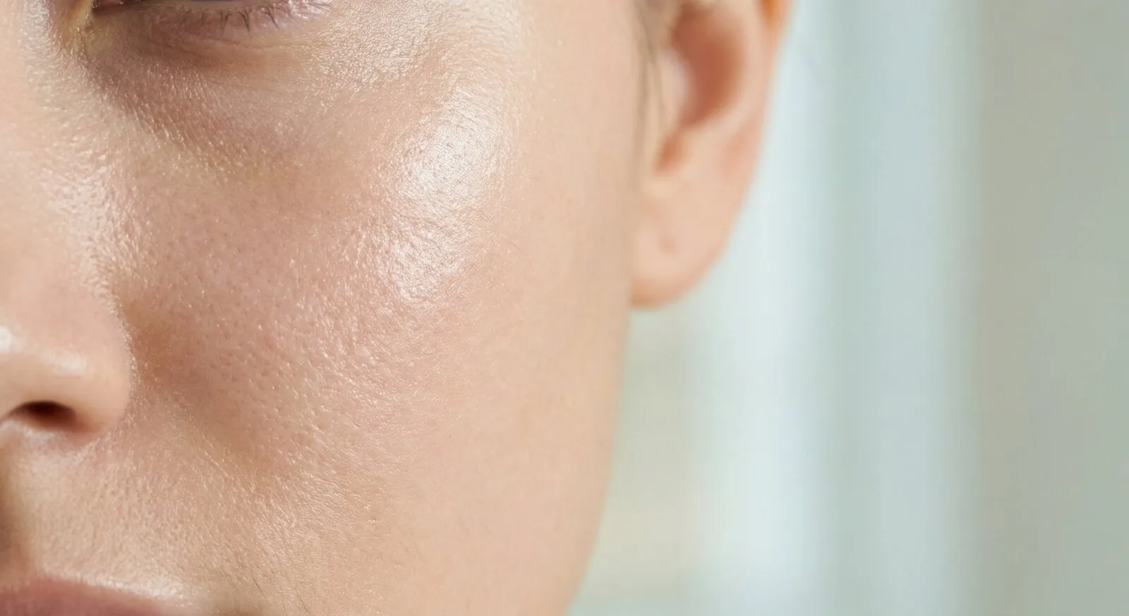 Close-up de pele facial com textura para explicar dermoabrasão em cicatrizes de acne