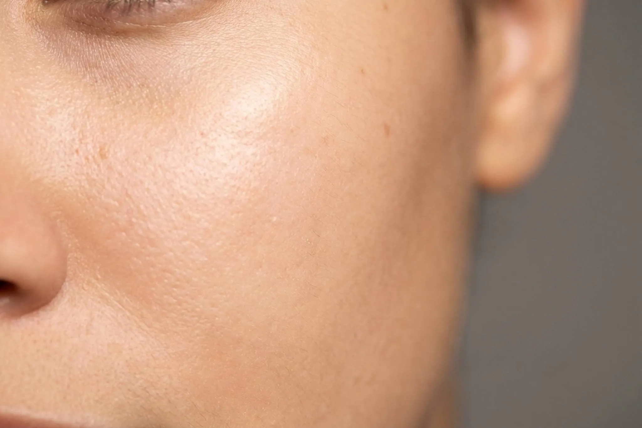 Dermoabrasão em Londrina